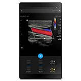 Портативний ручний УЗД апарат Philips Lumify, фото 6