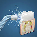 Насадка для іригатора Waterpulse YJ-300 (1 шт.), фото 2