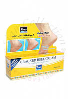 Крем от трещин на пятках Yoko Cracked Heel Cream