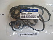 Прокладка клапанної кришки Kia Magentis