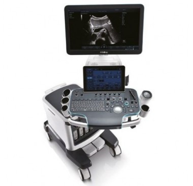 Стаціонарний УЗД апарат експертного класу Resona 7, фото 1