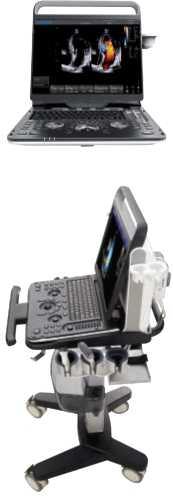 Ультразвуковий апарат EBit 60, фото 1