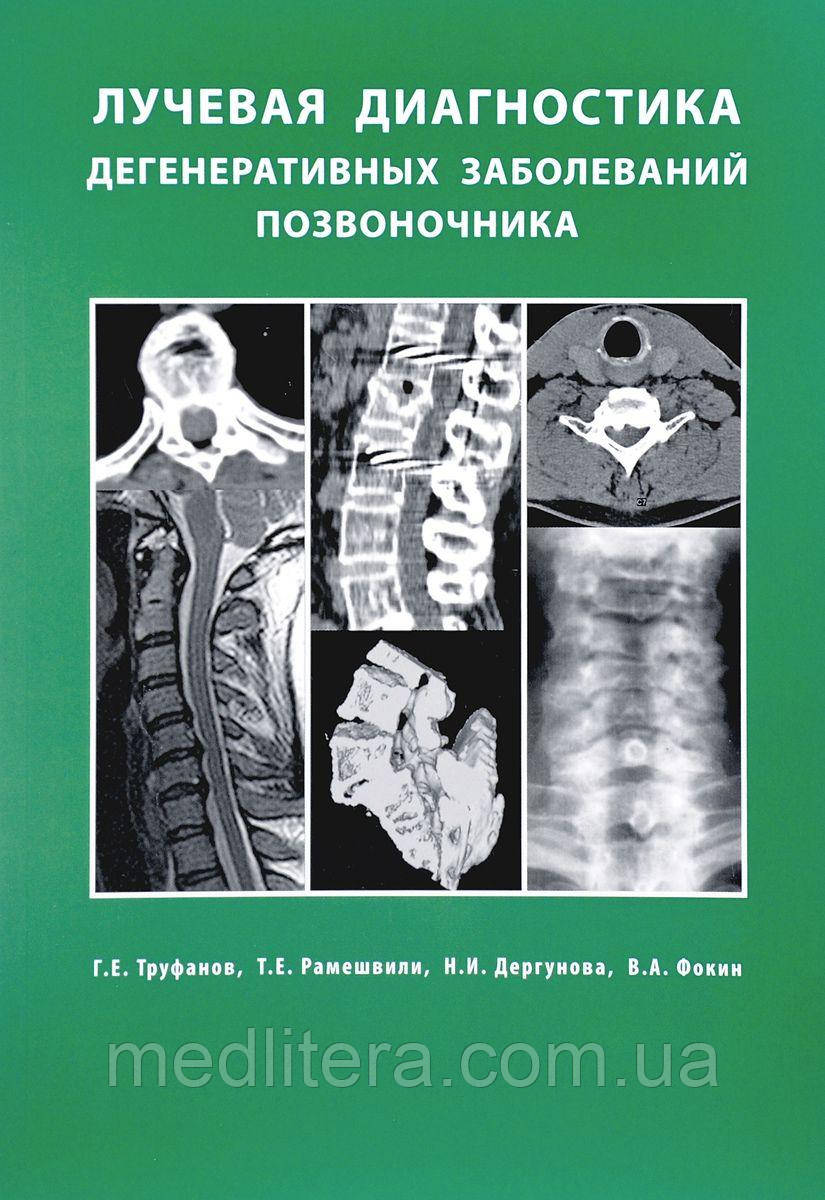 Труфанов Р. Е. Променева діагностика дегенеративних захворювань хребта