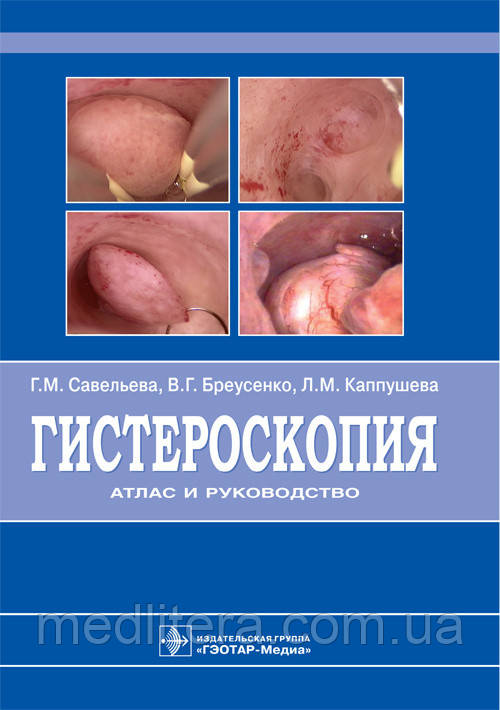 Савельєва Р. М., Бреусенко В. Р., Каппушева Л. М. Гістероскопія. Атлас і керівництво