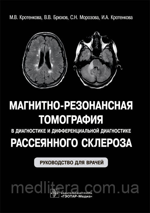 Кротенкова М. В. Магнітно-резонансна томографія в діагностиці та діфф. діагностиці розсіяного склерозу