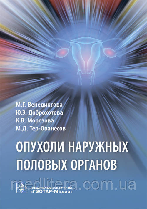 Венедиктова М. Р., Доброхотова Ю. Е., Морозова К. В., Тер-Ованесов М. Д. Пухлини зовнішніх статевих органів