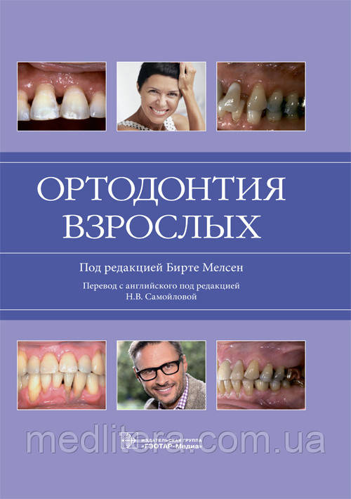 Мелсен Бирте Ортодонтія дорослих 2019 рік