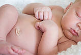 Бандаж пупковий дитячий для новонароджених у Дніпрі, фото 3