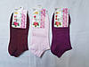 Каердан жіночі короткі шкарпетки, фото 3