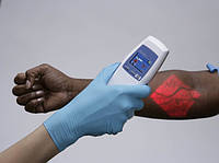 Васкулярні сканери