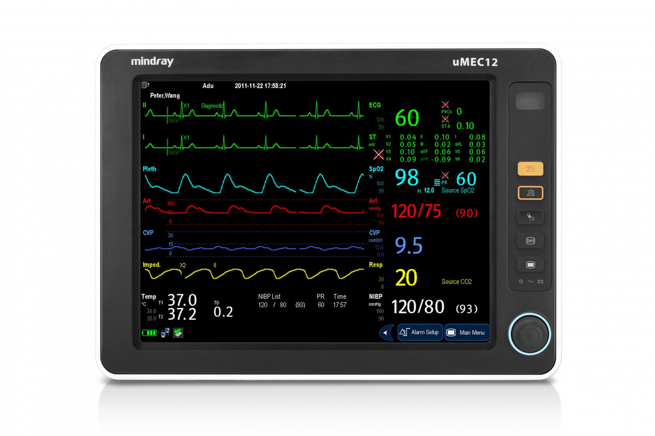 Монітор пацієнта uMEC12, фото 1