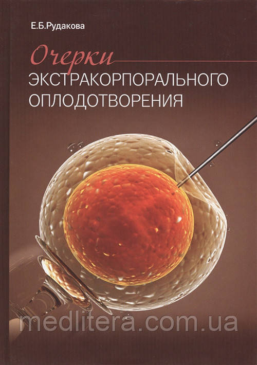 Рудакова Е. Б. Нариси екстракорпорального запліднення