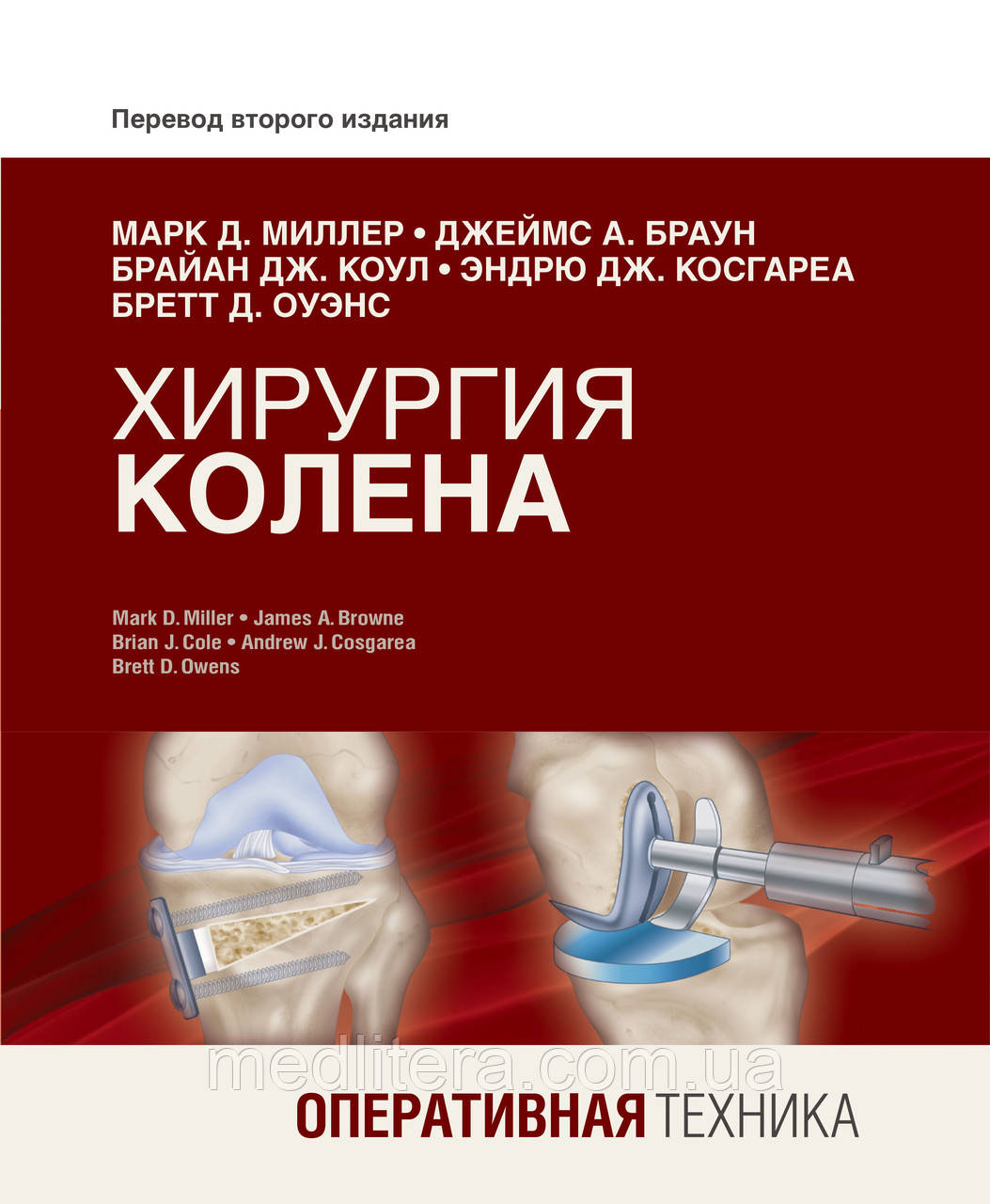 Марк Д. Міллер, Джеймс А. Браун Хірургія коліна. Оперативна техніка