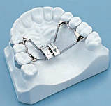 Посилення гвинт з телескопічною направляючою Leone (Леоне) А2620-12, фото 4