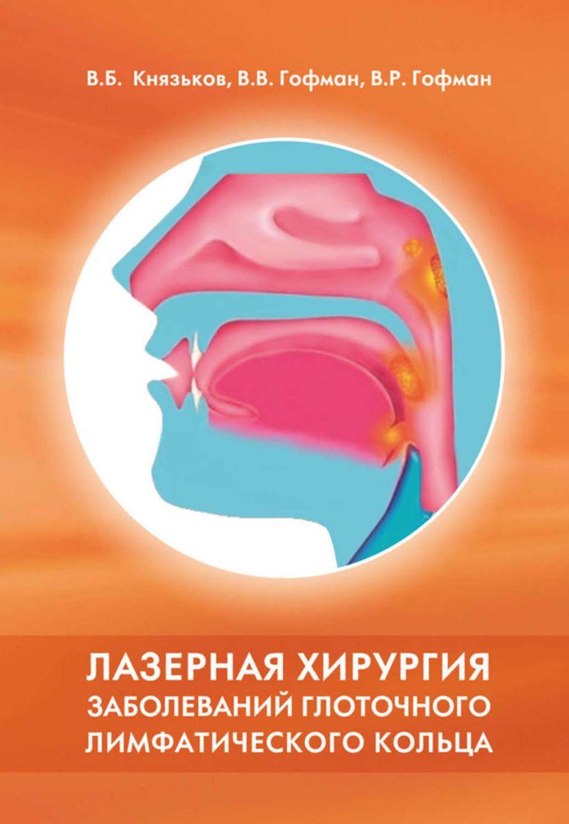 Лазерна хірургія захворювань глотичного лімфатичного кільця.