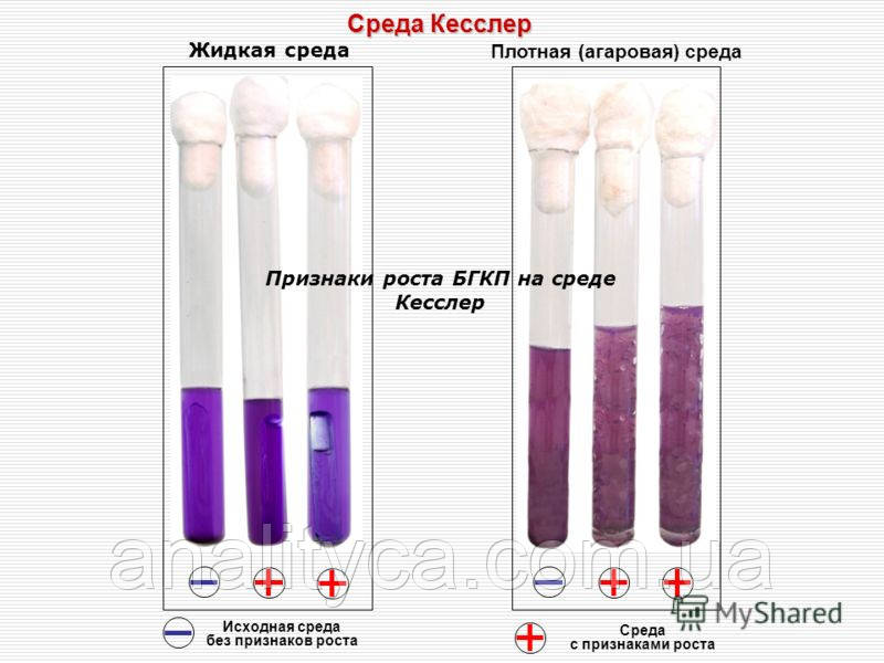 Середовище Кесслера