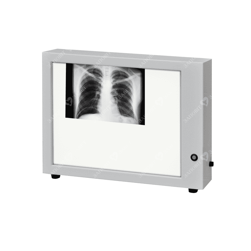 Негатоскоп Н-1, фото 1