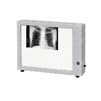 Негатоскоп Н-1