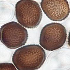 Tilletia Intermedia (Gessner)