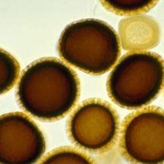 Tilletia indica Mitra