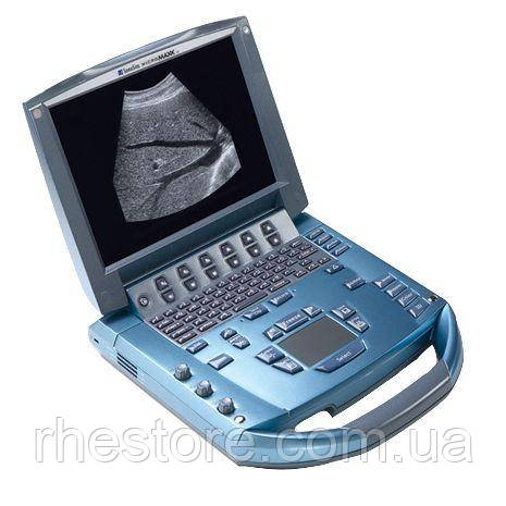Портативний УЗД апарат SONOSITE MICROMAX