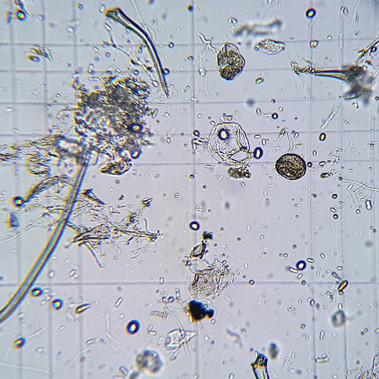 Фото з окуляра мікроскопа: 16х+10Х.