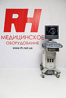 УЗД апарати