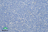 Рідкі шпалери тип Орхідея 811