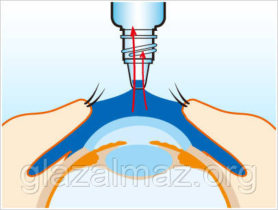 Інструкція застосування очних крапель Інструкція застосування очних крапель