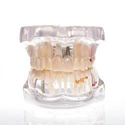 Демонстраційна Модель зі знімними мостами