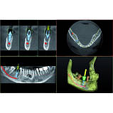 Томограф I-MAX Touch 3D, фото 3