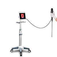 Відеогістероскоп