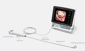 Відеобронхоскоп одноразовий