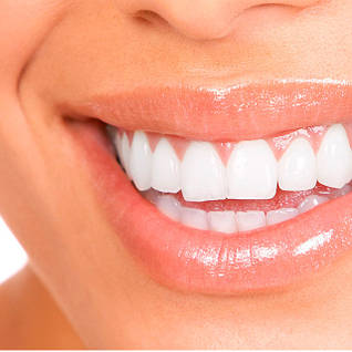 Засоби для відбілювання зубів