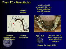 Removable Partial Design & Full Dentures Package