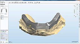 Abutment Designer and Implant Bar and Bridge Design Package