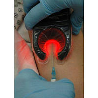 Портативный венозный сканер для пункции периферических кровеносных сосудов-Veinlite