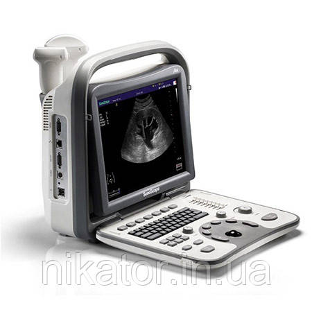 ЗІП апарат SonoScape A6V + 1 датчик, фото 1