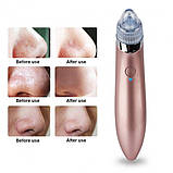 Вакуумний очищувач шкіри Beauty Skin XN-8030, фото 5