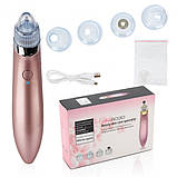 Вакуумний очищувач шкіри Beauty Skin XN-8030, фото 6