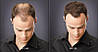 Загущувач для волосся Toppik Hair Building Fibers, фото 4