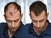 Загущувач для волосся Toppik Hair Building Fibers, фото 5