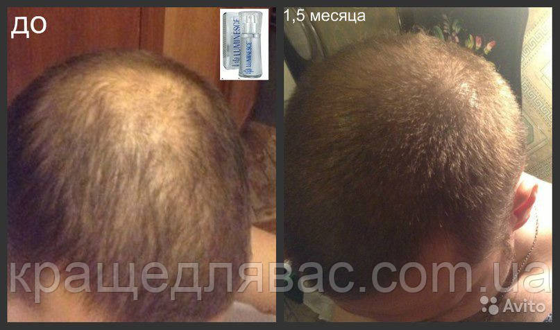 Лифтинг-маска LUMINESCE - фото 10 - id-p122395709