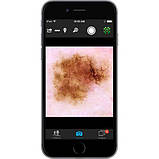 Дерматоскоп VEOS DS3, фото 2