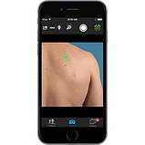 Дерматоскоп VEOS DS3, фото 3