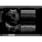 Ультразвуковий апарат EMP, фото 5