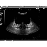 Ультразвуковий апарат EMP, фото 6