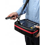 Портативний ультразвуковий апарат V9, фото 3