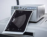 Б/В Універсальний ультразвуковий апарат Toshiba Aplio 500 + 3 Head Ultrasonograf (Cardio), фото 9