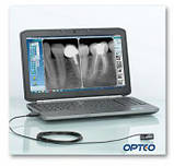 Візіограф OPTEO №2 (габаритні розміри датчика 43 х 31 х 5 мм) Медапаратура, фото 3